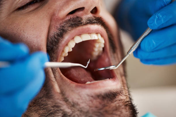 Best Broken or Cracked Tooth Emergency Dentist in Claremore, OK