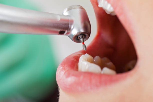 Professional Emergency Dentist in OK